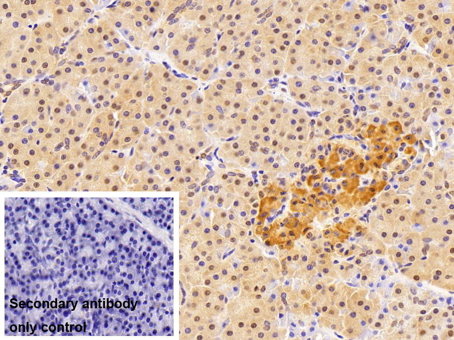 Polyclonal Antibody to Selenoprotein X1 (SEPX1)