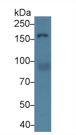 Polyclonal Antibody to Rho Associated Coiled Coil Containing Protein Kinase 1 (Rock1)