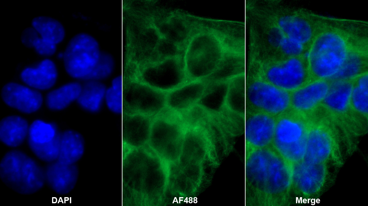 Polyclonal Antibody to Tubulin Beta 6 (TUBb6)