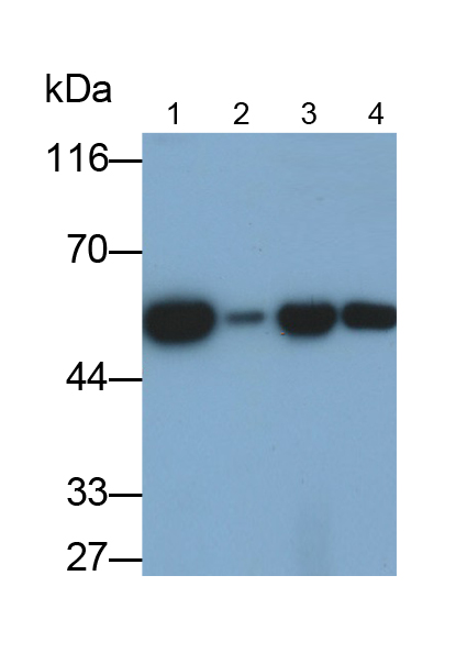 Polyclonal Antibody to Tubulin Alpha 4A (TUBa4A)