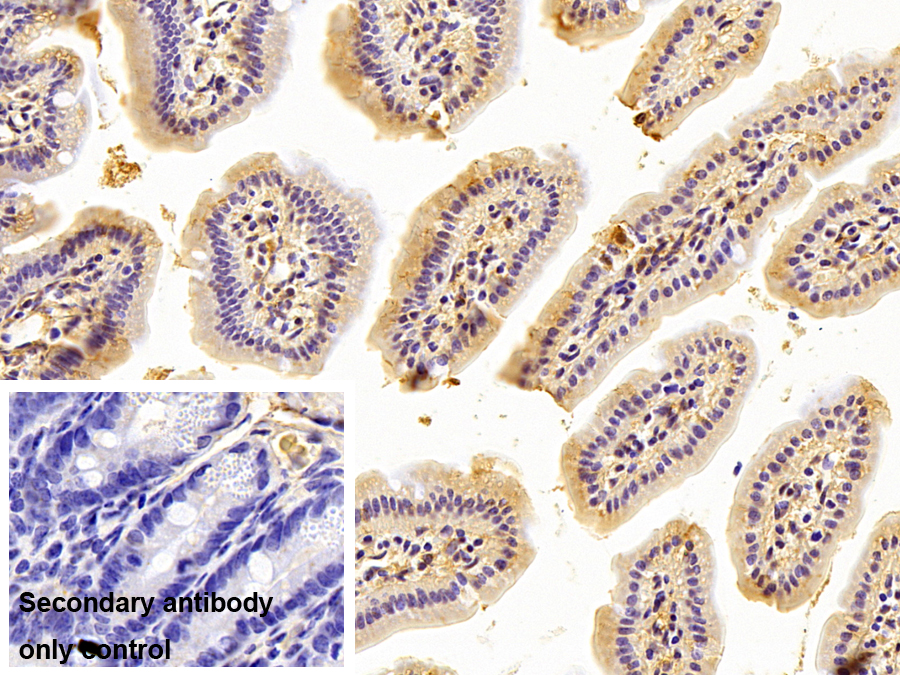 Polyclonal Antibody to Tubulin Alpha 4A (TUBa4A)