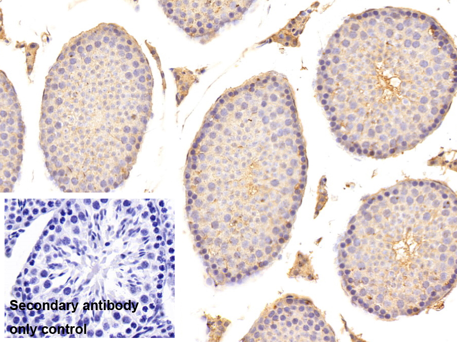 Polyclonal Antibody to Tubulin Folding Cofactor B (TBCB)