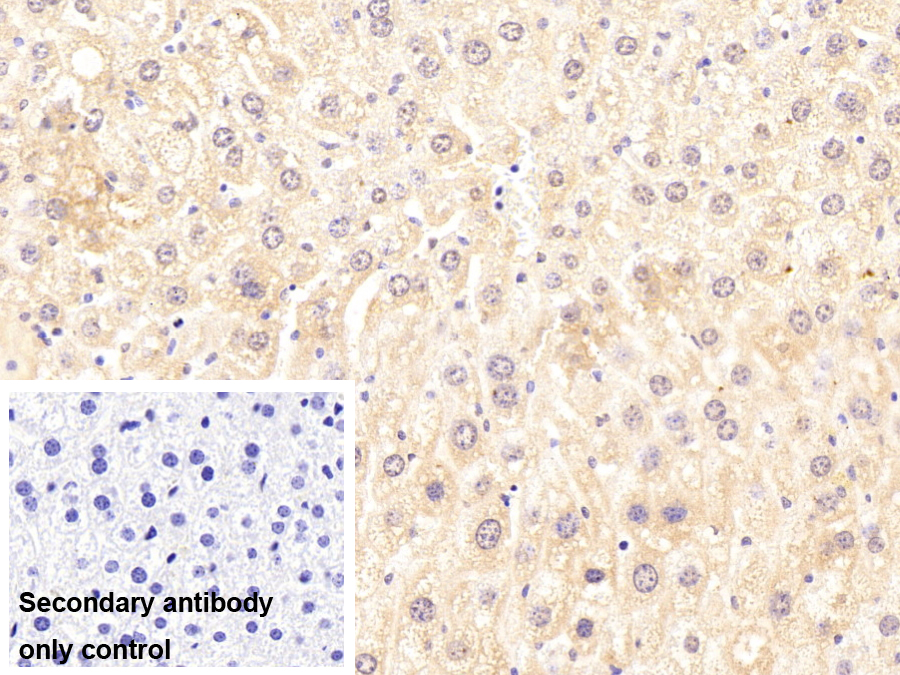Polyclonal Antibody to Tubulin Folding Cofactor B (TBCB)