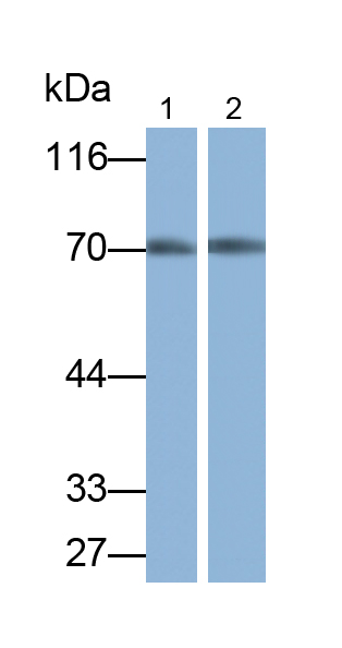 Polyclonal Antibody to Phosphoglucomutase 3 (PGM3)