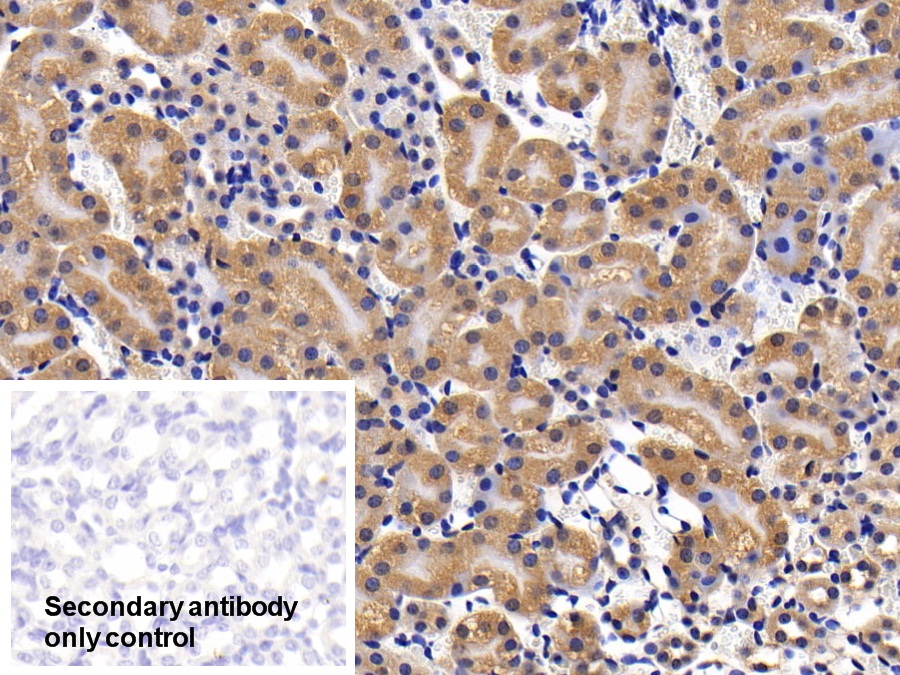 Polyclonal Antibody to Interleukin 11 Receptor Alpha (IL11Ra)