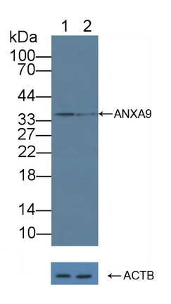 Polyclonal Antibody to Annexin A9 (ANXA9)