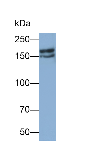 Polyclonal Antibody to Nuclear Receptor Coactivator 3 (NCOA3)