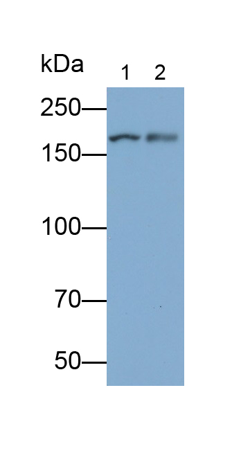 Polyclonal Antibody to Glutamate Receptor, Ionotropic, N-Methyl-D-Aspartate 2B (GRIN2B)