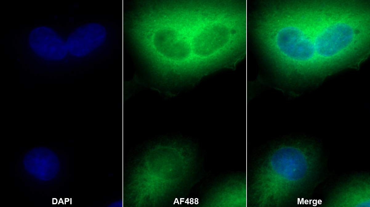 Polyclonal Antibody to Aldehyde Dehydrogenase 1 Family, Member A1 (ALDH1A1)