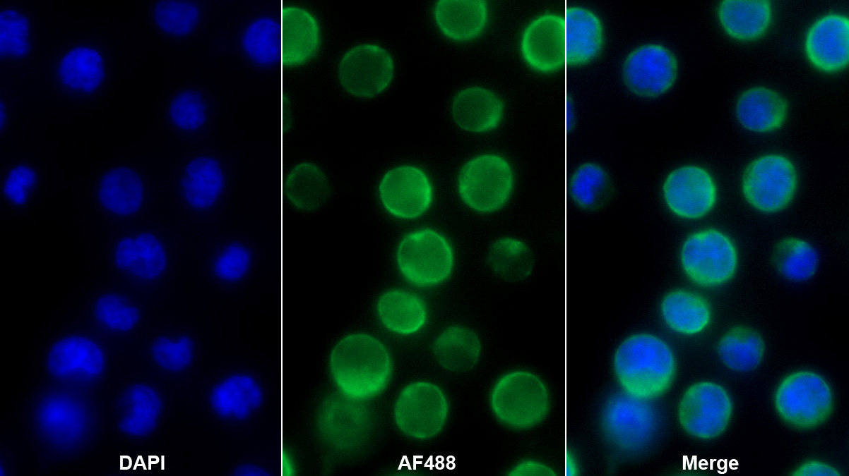 Polyclonal Antibody to Diacylglycerol Kinase Epsilon (DGKe)