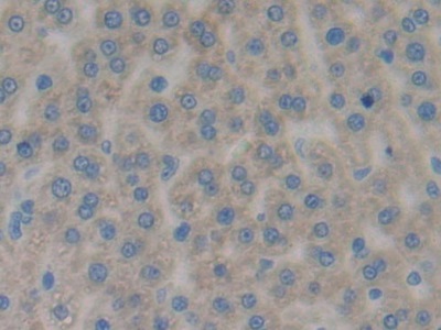 Polyclonal Antibody to Diacylglycerol Kinase Gamma (DGKg)