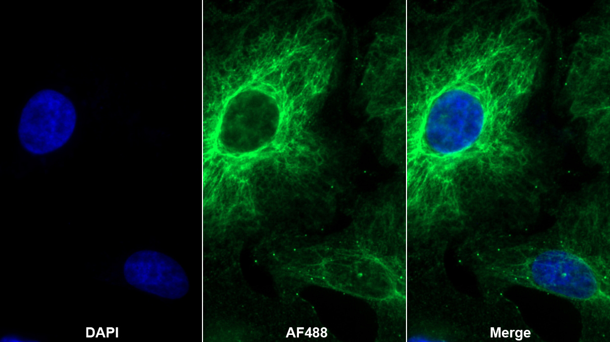 Polyclonal Antibody to A Kinase Anchor Protein 12 (AKAP12)