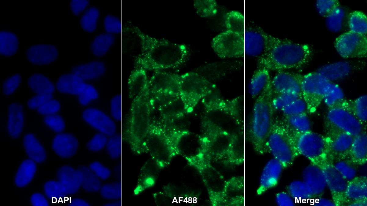 Polyclonal Antibody to Catenin Beta Interacting Protein 1 (CTNNbIP1)