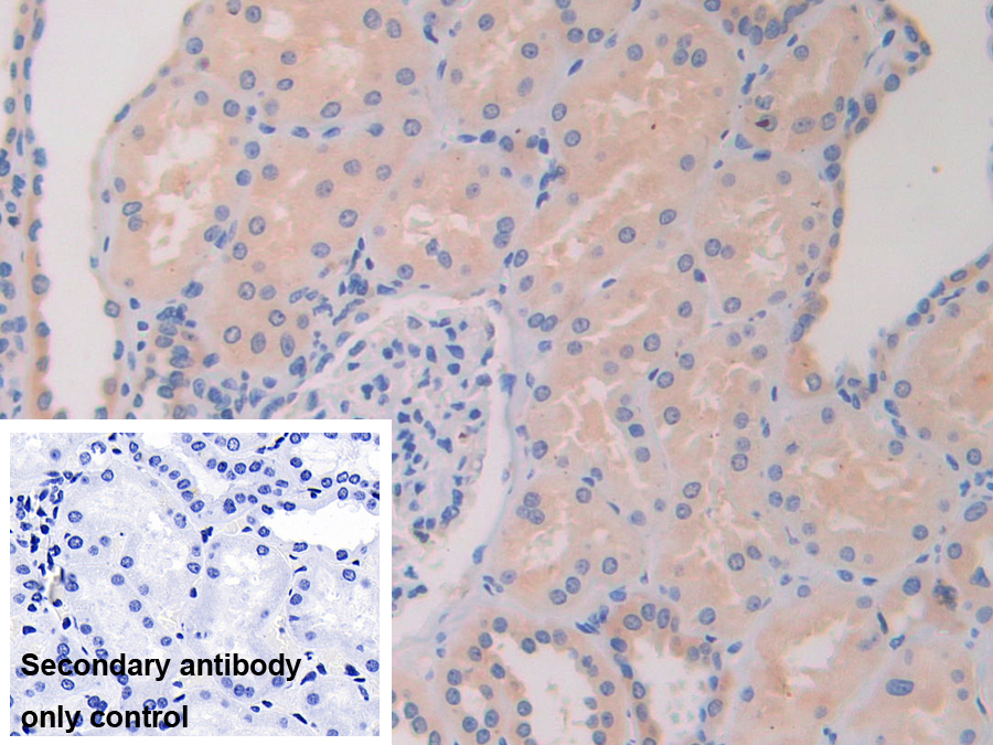 Polyclonal Antibody to Histone Deacetylase 6 (HDAC6)