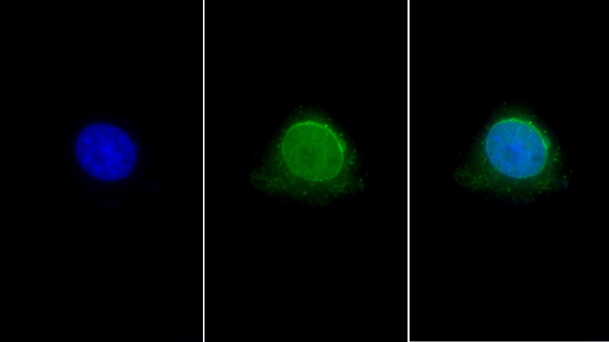 Polyclonal Antibody to Histone Deacetylase 6 (HDAC6)