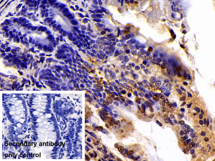 Polyclonal Antibody to Sirtuin 6 (SIRT6)