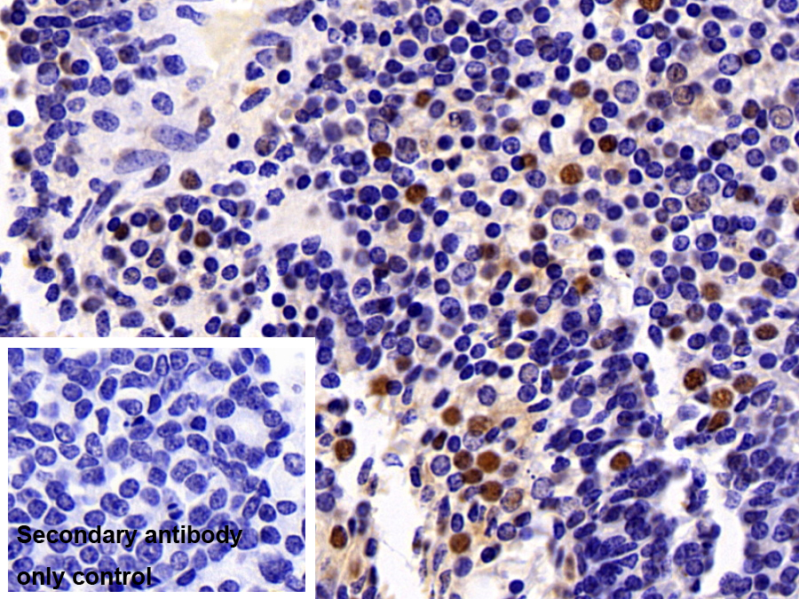 Polyclonal Antibody to Sirtuin 6 (SIRT6)