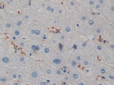 Polyclonal Antibody to Filamin B Beta (FLNb)