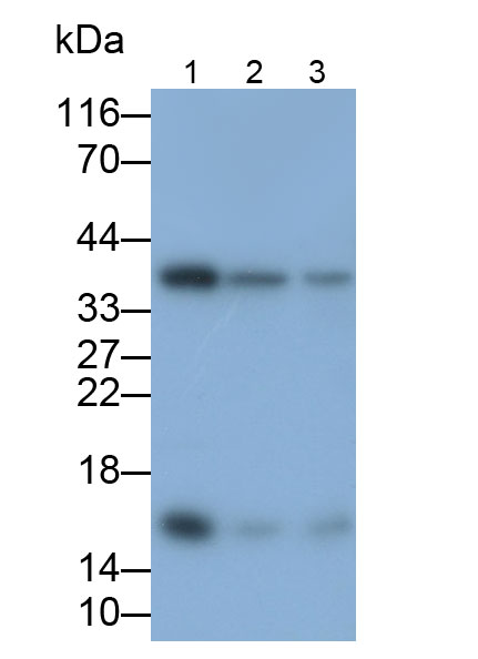 Polyclonal Antibody to Ribosomal Protein, Large, P2 (RPLP2)