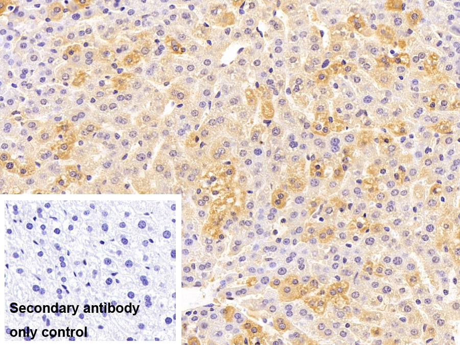 Polyclonal Antibody to Ribosomal Protein, Large, P2 (RPLP2)