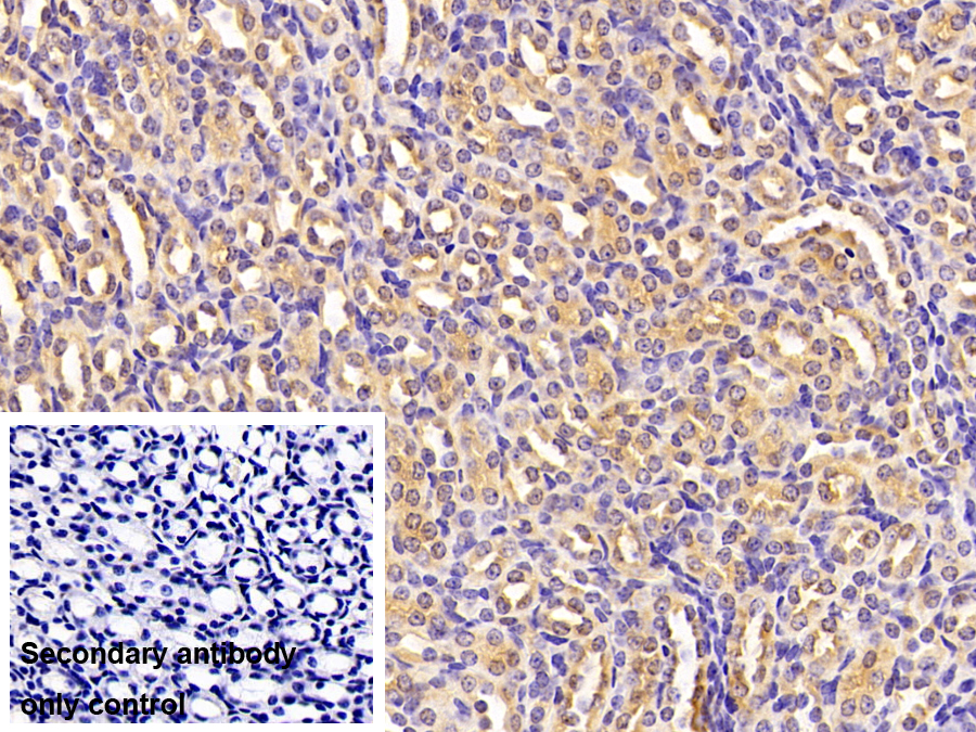 Polyclonal Antibody to Ribosomal Protein, Large, P2 (RPLP2)