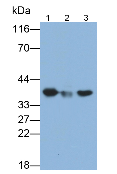 Polyclonal Antibody to Eukaryotic Translation Initiation Factor 3M (EIF3M)