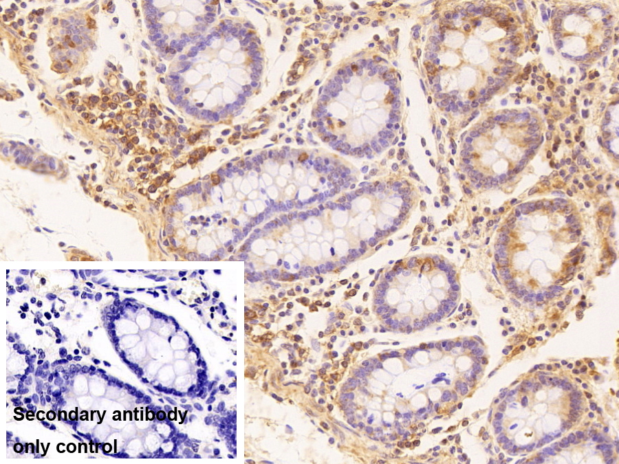 Polyclonal Antibody to Eukaryotic Translation Initiation Factor 3M (EIF3M)