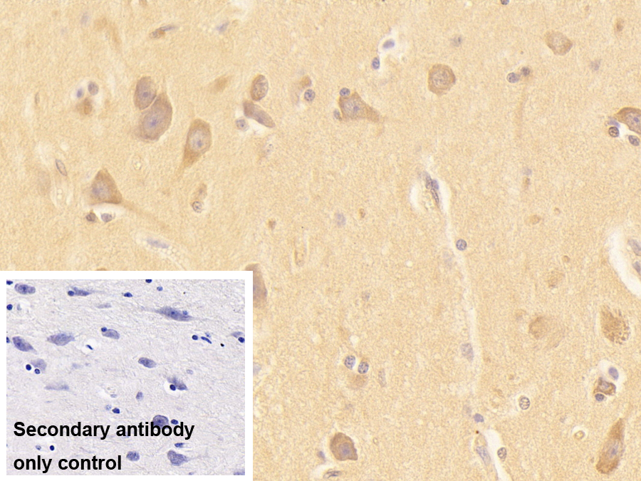 Polyclonal Antibody to Eukaryotic Translation Initiation Factor 3M (EIF3M)