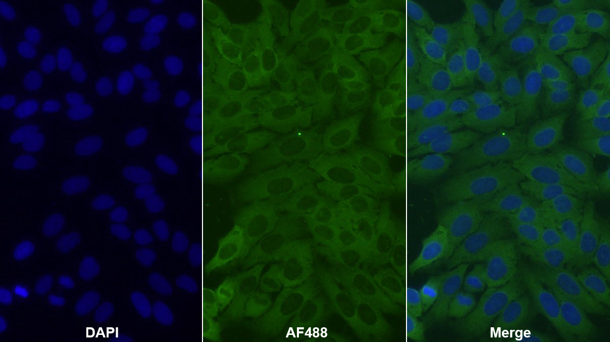 Polyclonal Antibody to Eukaryotic Translation Initiation Factor 4A1 (EIF4A1)