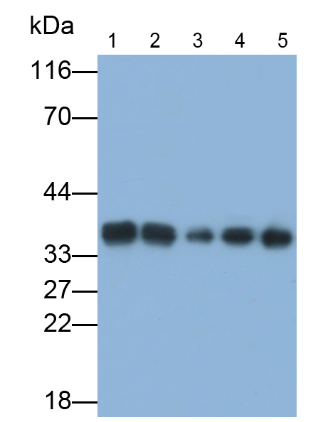Polyclonal Antibody to Eukaryotic Translation Elongation Factor 1 Delta (EEF1d)