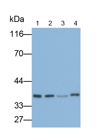 Polyclonal Antibody to Ribosomal Protein L6 (RPL6)