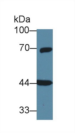 Polyclonal Antibody to G Protein Alpha 11 (GNa11)