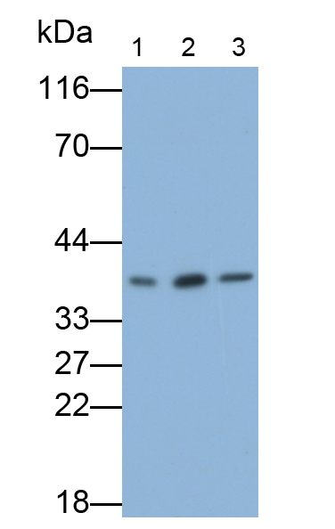 Polyclonal Antibody to Wilms Tumor Protein (WT1)