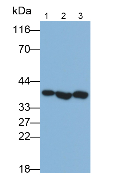 Polyclonal Antibody to Wilms Tumor Protein (WT1)