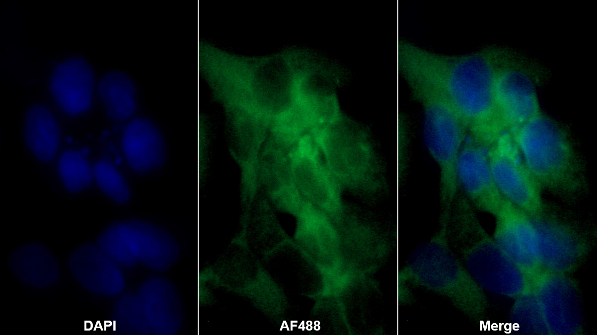 Polyclonal Antibody to 17-Beta-Hydroxysteroid Dehydrogenase Type 12 (HSD17b12)