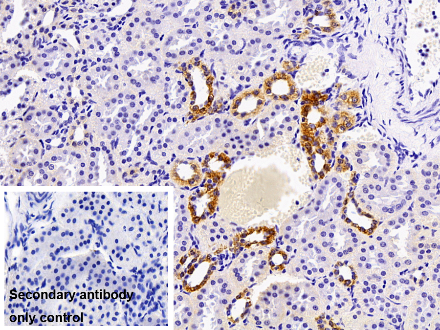 Polyclonal Antibody to 11-Beta-Hydroxysteroid Dehydrogenase Type 2 (HSD11b2)