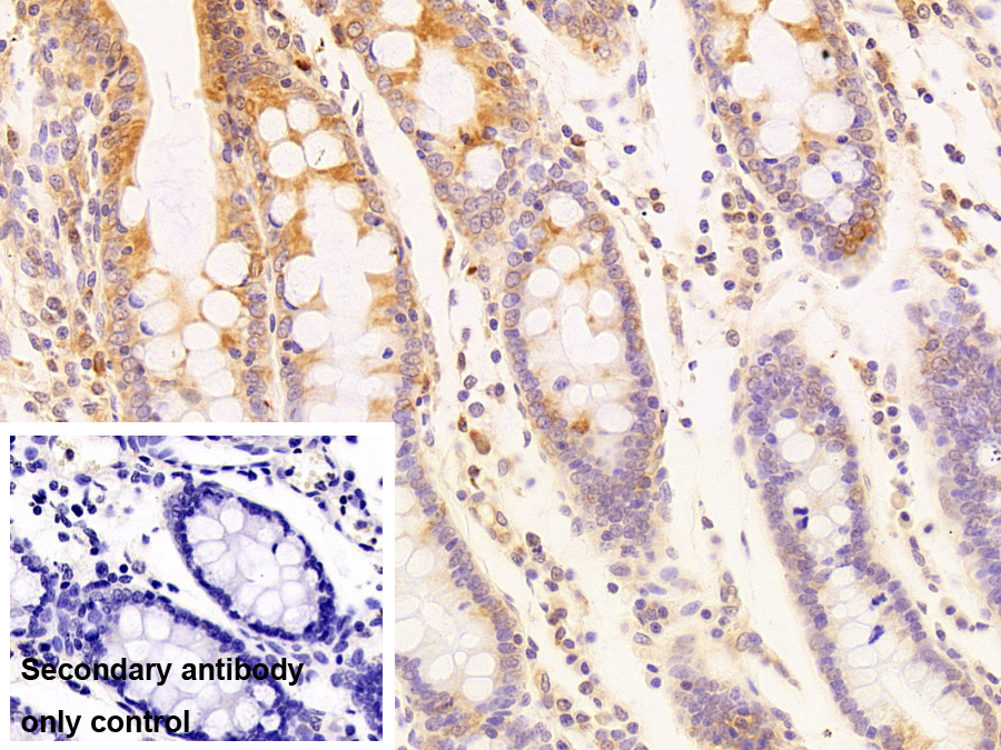 Polyclonal Antibody to Carboxylesterase 3 (CES3)