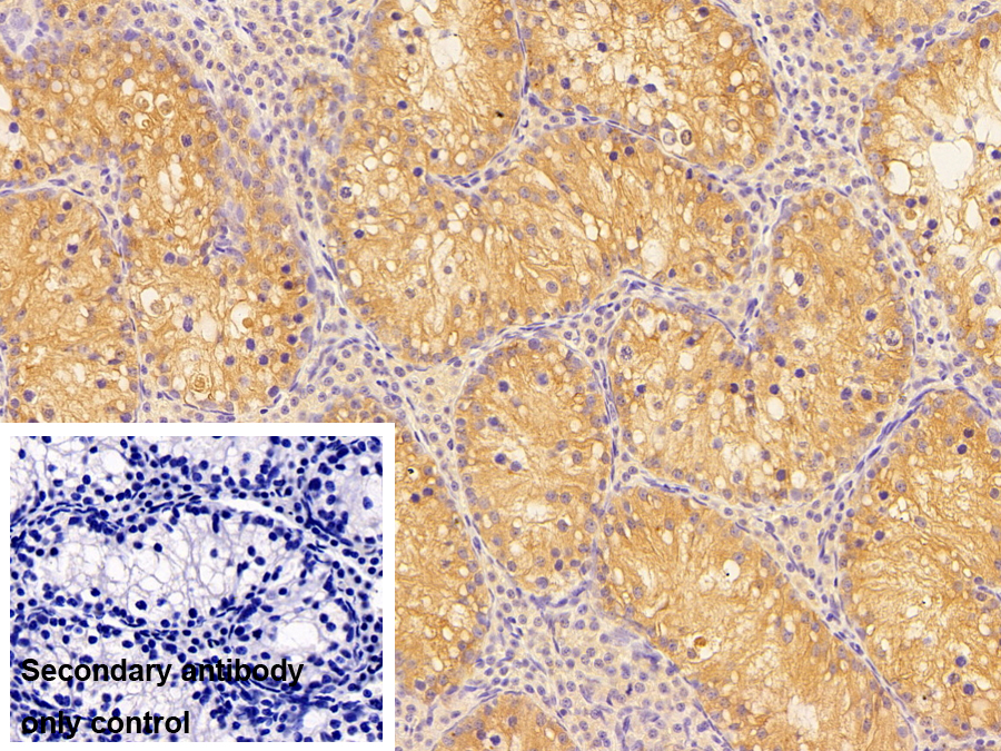 Polyclonal Antibody to Carboxylesterase 3 (CES3)