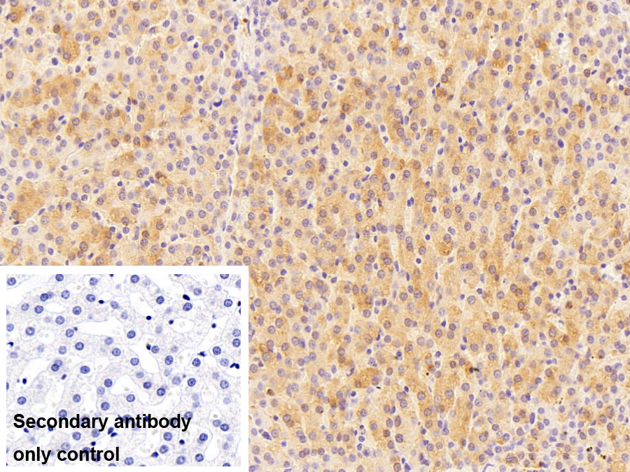 Polyclonal Antibody to Carboxylesterase 3 (CES3)