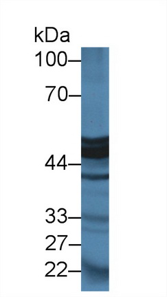 Polyclonal Antibody to Carboxypeptidase A1, Pancreatic (CPA1)