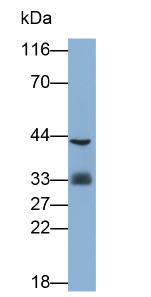Polyclonal Antibody to Crystallin Lambda 1 (CRYl1)