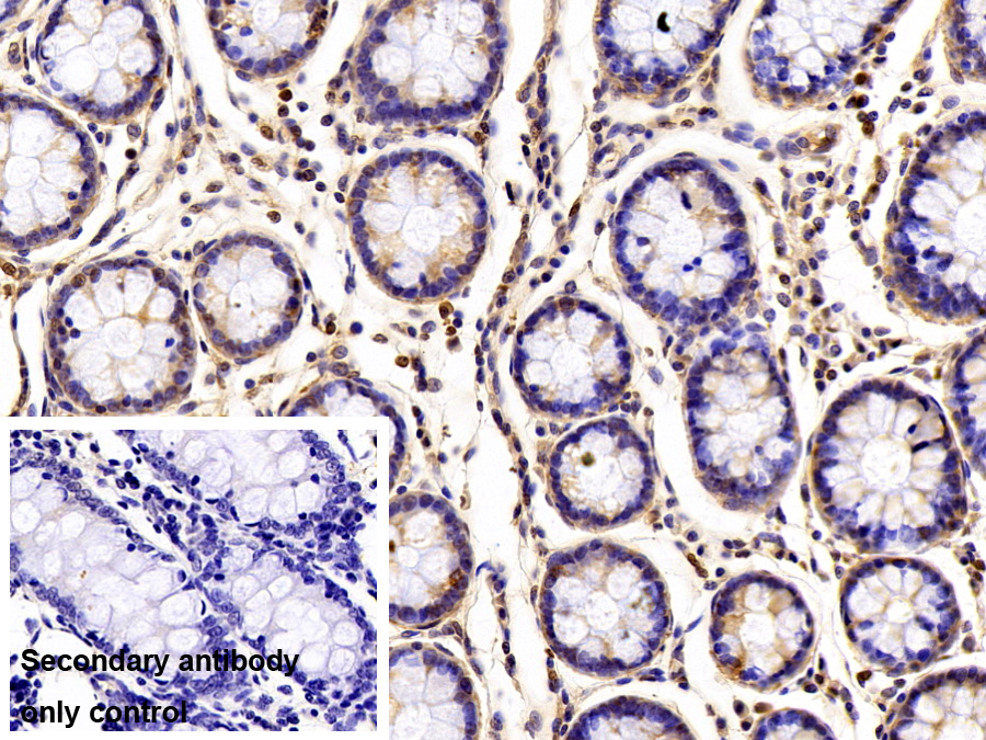 Polyclonal Antibody to Crystallin Lambda 1 (CRYl1)