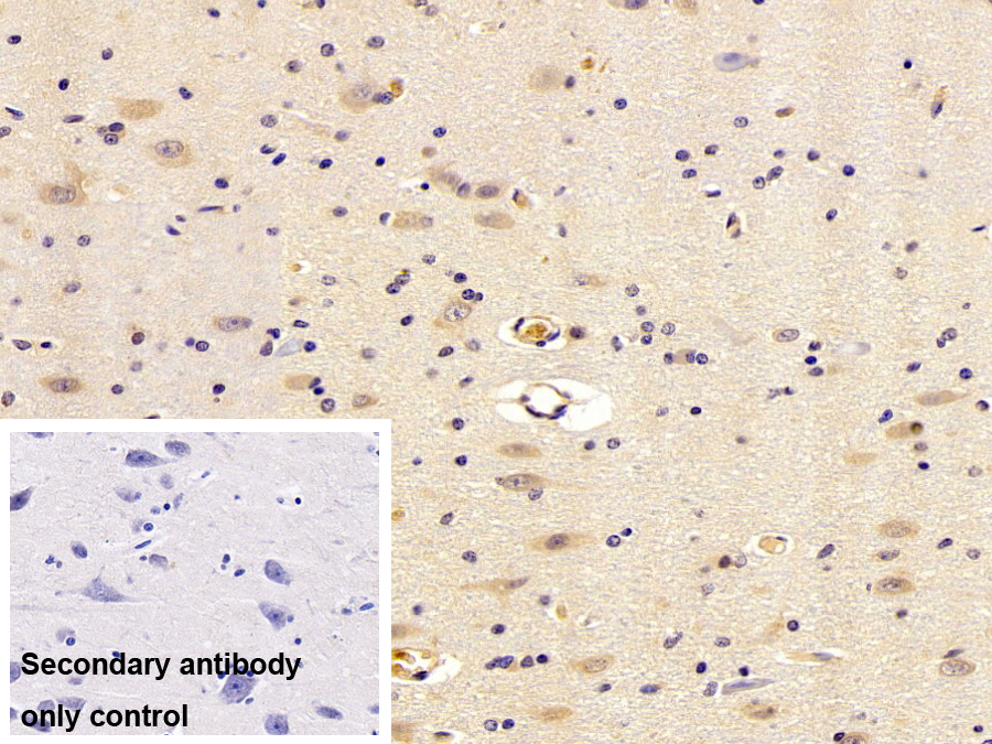 Polyclonal Antibody to Crystallin Lambda 1 (CRYl1)