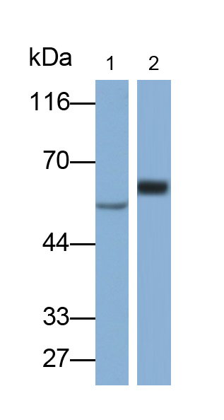 Polyclonal Antibody to Fatty Acid Desaturase 2 (FADS2)