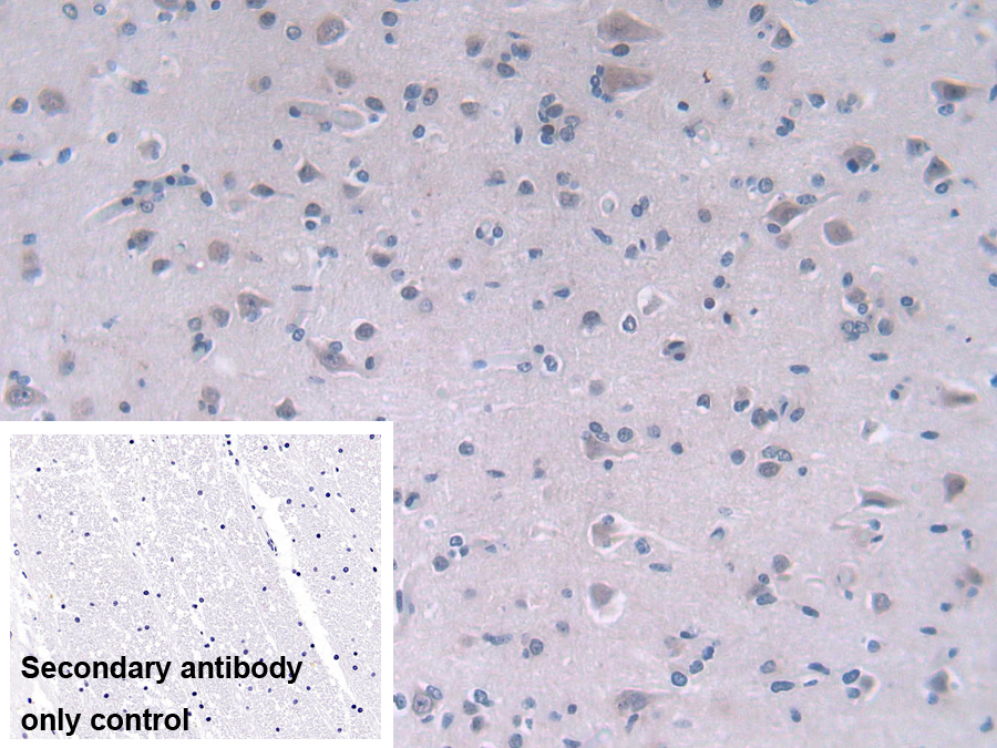 Polyclonal Antibody to Fatty Acid Desaturase 2 (FADS2)