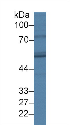 Polyclonal Antibody to Fatty Acid Desaturase 3 (FADS3)