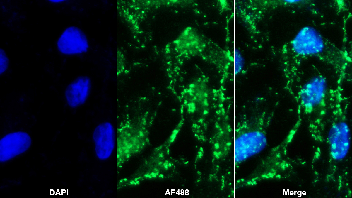 Polyclonal Antibody to Fibulin 4 (FBLN4)