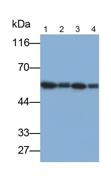 Polyclonal Antibody to Calsequestrin 2 (CASQ2)