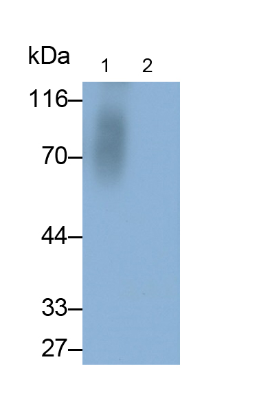 Polyclonal Antibody to Kisspeptin Receptor (KISS1R)