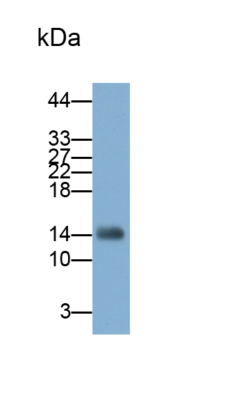 Polyclonal Antibody to Leukocyte Cell Derived Chemotaxin 2 (LECT2)
